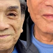 Dedé Santana mostra resultado de harmonização facial.