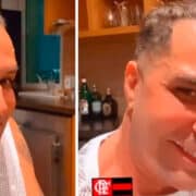 Latino surge irreconhecível na web um mês após harmonização facial
